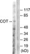 Mitogen-Activated Protein Kinase Kinase Kinase 8 antibody, LS-C117557, Lifespan Biosciences, Western Blot image 