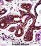 Programmed Cell Death 4 antibody, abx027732, Abbexa, Immunohistochemistry paraffin image 