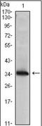 NME/NM23 Nucleoside Diphosphate Kinase 1 antibody, orb89458, Biorbyt, Western Blot image 