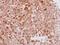 Keratin 16 antibody, GTX100838, GeneTex, Immunohistochemistry paraffin image 