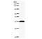 Paired Box 3 antibody, LS-C342555, Lifespan Biosciences, Western Blot image 