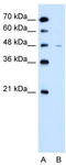 Solute Carrier Family 43 Member 3 antibody, TA333769, Origene, Western Blot image 