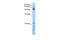 RecQ Like Helicase 5 antibody, 28-480, ProSci, Enzyme Linked Immunosorbent Assay image 