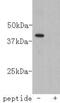 Ceramide Synthase 2 antibody, NBP2-66930, Novus Biologicals, Western Blot image 