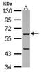 Phospholipase A2 Group IVF antibody, NBP2-19855, Novus Biologicals, Western Blot image 