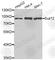 SUZ12 Polycomb Repressive Complex 2 Subunit antibody, A5429, ABclonal Technology, Western Blot image 