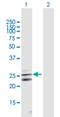 Cytokine Receptor Like Factor 1 antibody, H00023529-B03P, Novus Biologicals, Western Blot image 