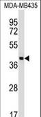 Surfactant Protein D antibody, LS-C169038, Lifespan Biosciences, Western Blot image 