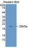 Glia Maturation Factor Beta antibody, LS-C374338, Lifespan Biosciences, Western Blot image 