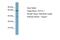 T-Complex 11 Like 1 antibody, A16803, Boster Biological Technology, Western Blot image 