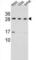 CD79a antibody, abx027180, Abbexa, Western Blot image 