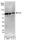 FUS RNA Binding Protein antibody, A303-839A, Bethyl Labs, Western Blot image 