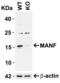 Mesencephalic Astrocyte Derived Neurotrophic Factor antibody, GTX31324, GeneTex, Western Blot image 