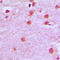 Homeobox A11 antibody, LS-C352306, Lifespan Biosciences, Immunohistochemistry paraffin image 