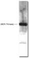 MER Proto-Oncogene, Tyrosine Kinase antibody, PA1-31203, Invitrogen Antibodies, Western Blot image 