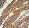 Poly(A) Specific Ribonuclease Subunit PAN3 antibody, LS-C163353, Lifespan Biosciences, Immunohistochemistry paraffin image 