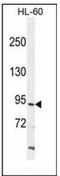 Inter-Alpha-Trypsin Inhibitor Heavy Chain 1 antibody, AP52255PU-N, Origene, Western Blot image 