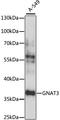 G Protein Subunit Alpha Transducin 3 antibody, A15982, ABclonal Technology, Western Blot image 