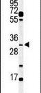 Apolipoprotein B MRNA Editing Enzyme Catalytic Subunit 3B antibody, PA5-11430, Invitrogen Antibodies, Western Blot image 