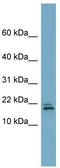 FANCD2 Opposite Strand antibody, TA337793, Origene, Western Blot image 