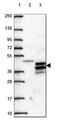 Kallikrein Related Peptidase 13 antibody, NBP2-49358, Novus Biologicals, Western Blot image 