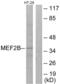 Myocyte Enhancer Factor 2B antibody, abx013567, Abbexa, Western Blot image 