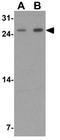 KH Domain Containing 1 antibody, GTX32118, GeneTex, Western Blot image 