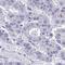 Transmembrane Protein 189 antibody, HPA059549, Atlas Antibodies, Immunohistochemistry frozen image 