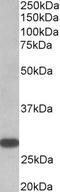 Thyroid Stimulating Hormone Receptor antibody, LS-C154893, Lifespan Biosciences, Western Blot image 