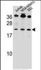 BCL2 Antagonist/Killer 1 antibody, PA5-11377, Invitrogen Antibodies, Western Blot image 
