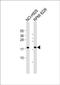 CD300 Molecule Like Family Member D antibody, PA5-72446, Invitrogen Antibodies, Western Blot image 