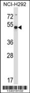 Actin Related Protein 6 antibody, 57-332, ProSci, Western Blot image 