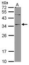 Deoxyribonuclease-2-beta antibody, NBP2-16199, Novus Biologicals, Western Blot image 