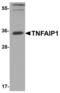 TNF Alpha Induced Protein 1 antibody, LS-B13092, Lifespan Biosciences, Western Blot image 