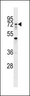 Ring Finger Protein 112 antibody, LS-C158861, Lifespan Biosciences, Western Blot image 