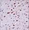 Protein Tyrosine Kinase 2 Beta antibody, LS-C164562, Lifespan Biosciences, Immunohistochemistry paraffin image 