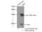 Hemoglobin Subunit Beta antibody, 16216-1-AP, Proteintech Group, Immunoprecipitation image 