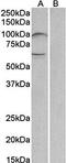 Unc-5 Netrin Receptor B antibody, orb167697, Biorbyt, Western Blot image 