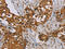 Proteasome 26S Subunit, ATPase 2 antibody, CSB-PA946590, Cusabio, Immunohistochemistry paraffin image 