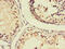 Absent In Melanoma 2 antibody, CSB-PA001499LA01HU, Cusabio, Immunohistochemistry paraffin image 
