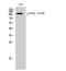 Protein Tyrosine Kinase 2 Beta antibody, A01066Y579, Boster Biological Technology, Western Blot image 