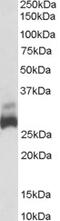 High Mobility Group AT-Hook 1 antibody, 45-737, ProSci, Immunohistochemistry paraffin image 