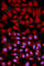 Mitogen-Activated Protein Kinase Kinase 6 antibody, A2575, ABclonal Technology, Immunofluorescence image 