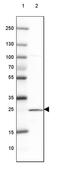ST6 N-Acetylgalactosaminide Alpha-2,6-Sialyltransferase 3 antibody, PA5-63122, Invitrogen Antibodies, Western Blot image 