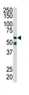 Receptor Interacting Serine/Threonine Kinase 2 antibody, abx033703, Abbexa, Immunohistochemistry paraffin image 