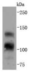 Fibroblast Growth Factor Receptor 1 antibody, A00098-1, Boster Biological Technology, Western Blot image 