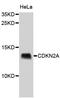 Cyclin Dependent Kinase Inhibitor 2A antibody, STJ23077, St John