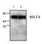 Solute Carrier Family 5 Member 2 antibody, ab37296, Abcam, Western Blot image 