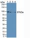 Glycogen Phosphorylase L antibody, LS-C304057, Lifespan Biosciences, Western Blot image 