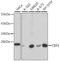 Chromobox 5 antibody, A1098, ABclonal Technology, Western Blot image 